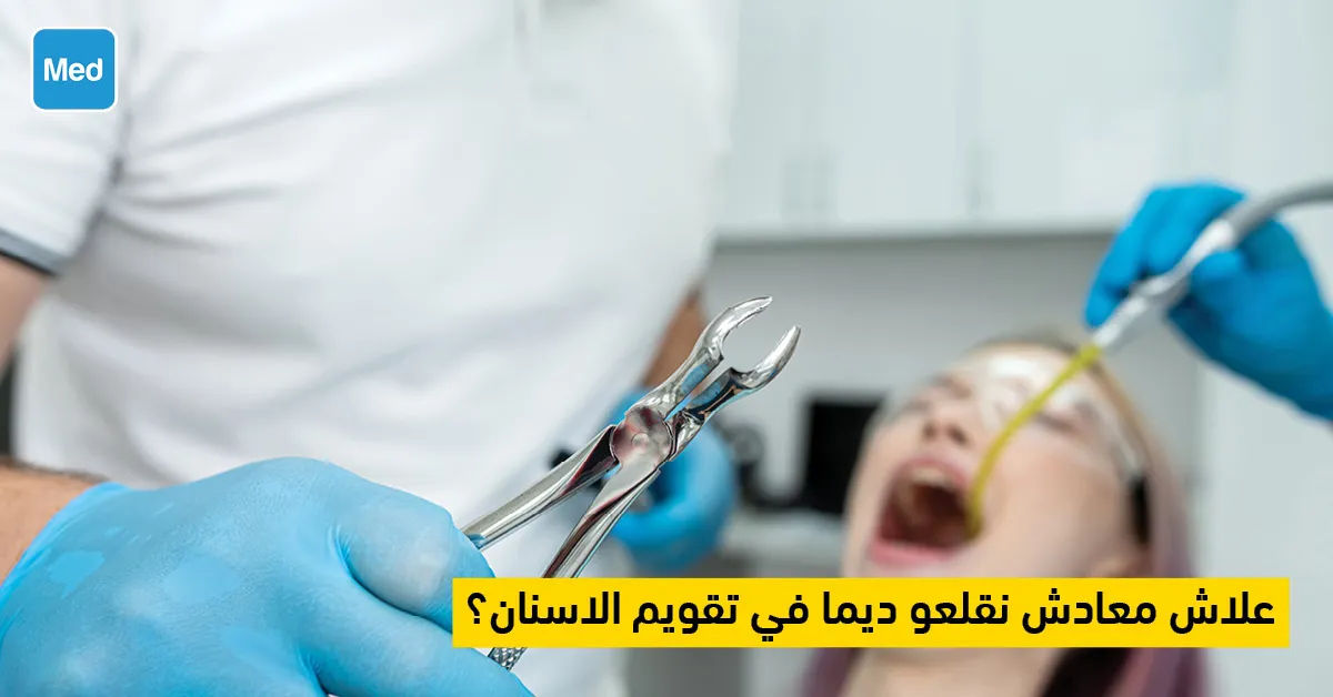علاش معادش نقلعو ديما في تقويم الاسنان؟